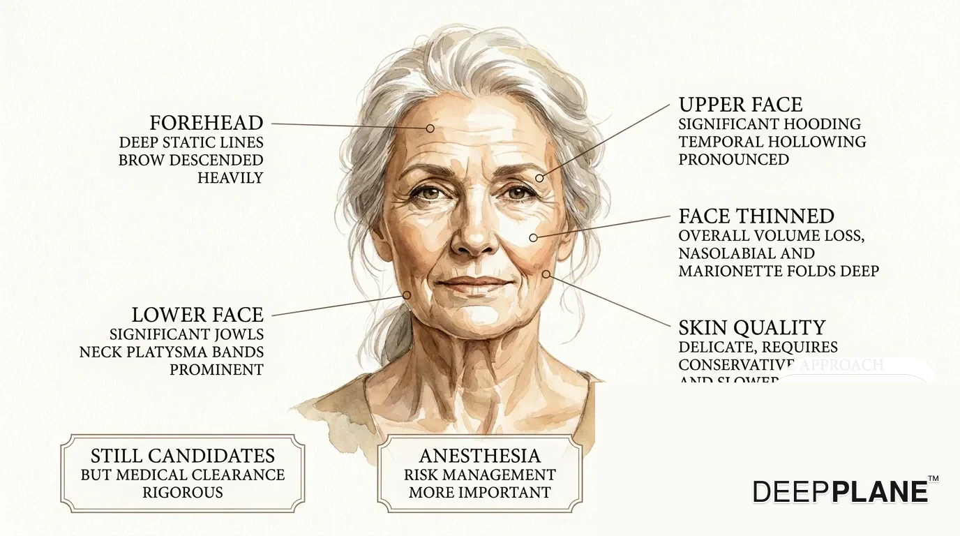 Facial aging considerations in the 70s with annotations on deep static lines, significant hooding and pronounced temporal hollowing, deep nasolabial and marionette folds, prominent jowls and platysma bands, delicate thin skin requiring conservative approach; still candidates with rigorous medical clearance, goal natural rejuvenation not trying to look 50