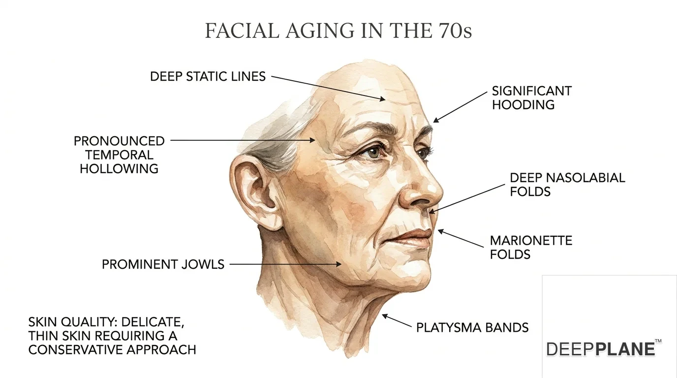 Facial aging considerations in the 70s with annotations on deep static lines, significant hooding and pronounced temporal hollowing, deep nasolabial and marionette folds, prominent jowls and platysma bands, delicate thin skin requiring conservative approach; still candidates with rigorous medical clearance, goal natural rejuvenation not trying to look 50
