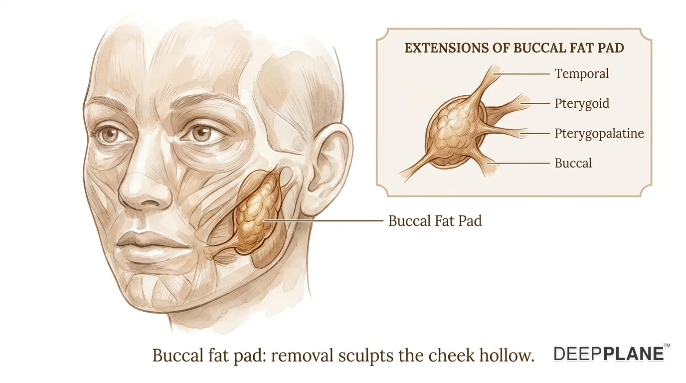Three-quarter face view with skin and superficial muscles translucent revealing the buccal fat pad as a distinct lobular structure deep in the cheek hollow, with inset showing the four extensions: buccal, pterygoid, temporal, and pterygopalatine