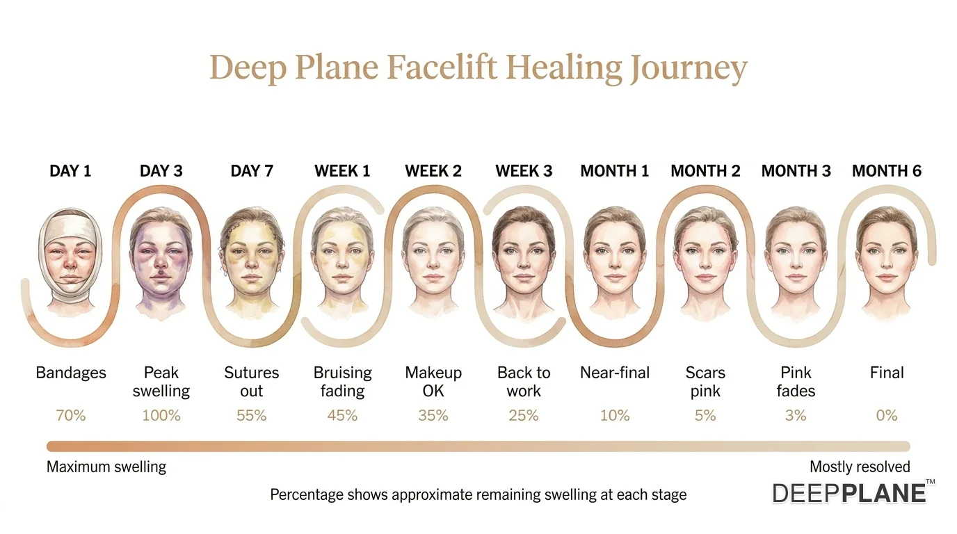 Ten-stage deep plane facelift healing journey from Day 1 bandages through peak swelling at Day 3, sutures out at Day 7, fading bruising at Week 1-2, back to work at Week 3, near-final at Month 1, fading scars at Months 2-3, and final natural result at Month 6