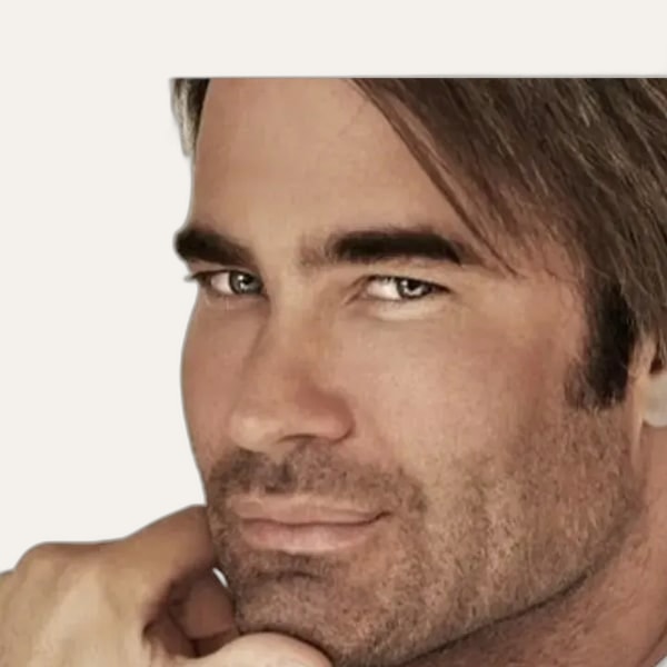 Dr. Dirk Kremer, deep plane facelift surgeon in London, UK