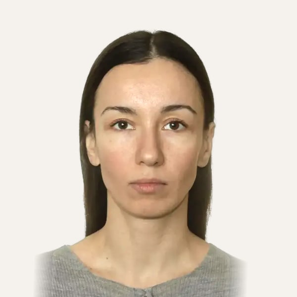 Dr. Elena Churilova — Hirurg za Deep Plane Facelift