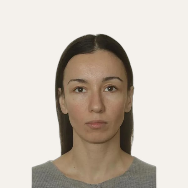 Dr. Elena Churilova, deep plane facelift surgeon in Moscow, Russia