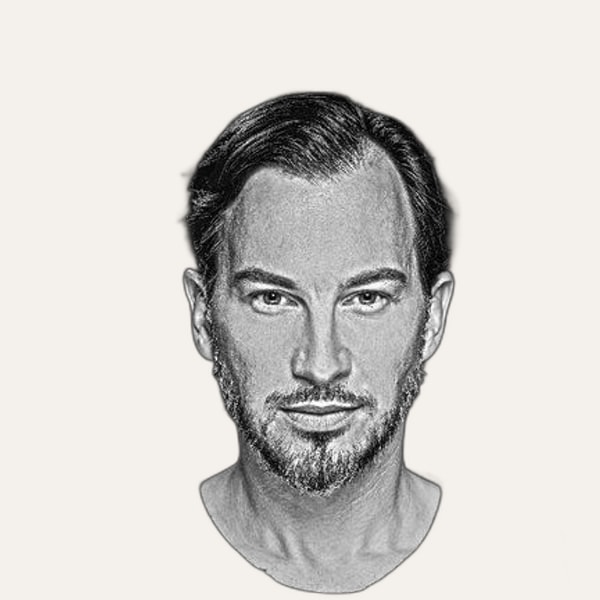 Dr. Georg Huemer, deep plane facelift surgeon in Vienna, Austria