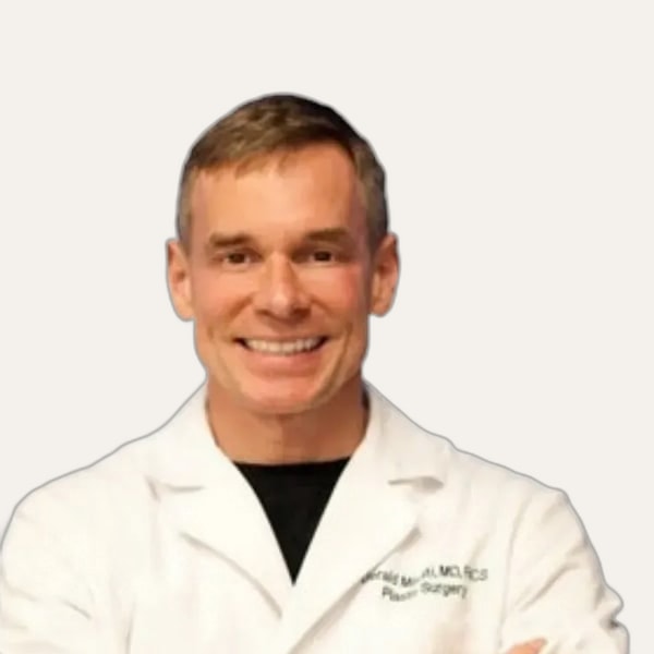 Dr. Gerald Minniti, deep plane facelift surgeon in Beverly Hills, USA