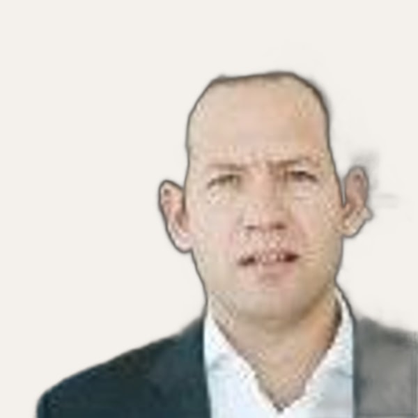 Dr. Jose Antonio Martínez Fernández — Χειρουργός λίφτινγκ προσώπου deep plane