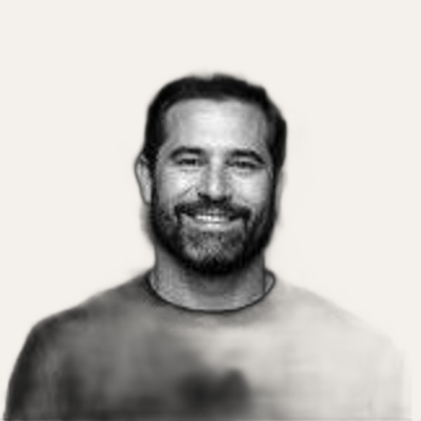 Dr. José Lasen, deep plane facelift surgeon in Santiago, Chile