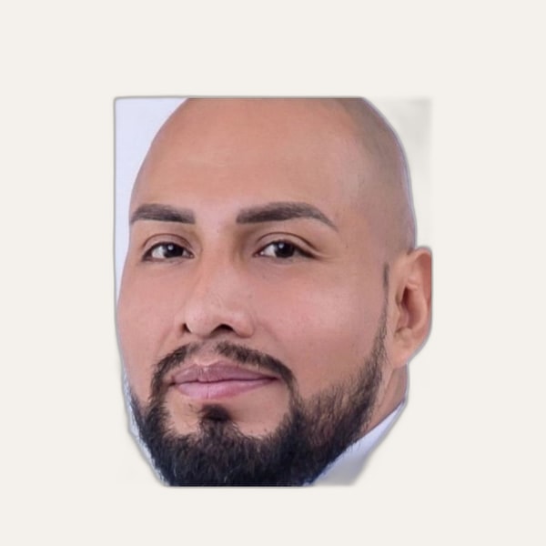 Dr. José Roberto Lema Balla — Deep Plane Facelift Surgeon