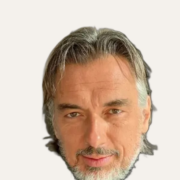 Dr. Michele Pascali, deep plane facelift surgeon in Rome, Italy