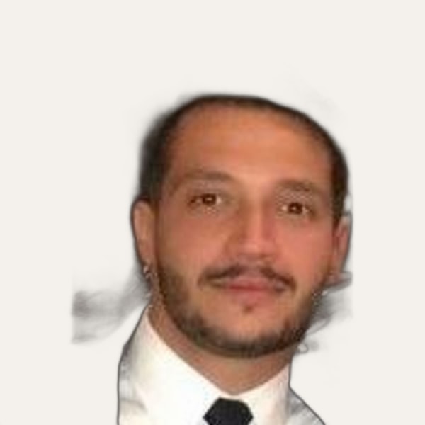 Dr. Mohamed El Guindy, deep plane facelift surgeon in Cairo, Egypt