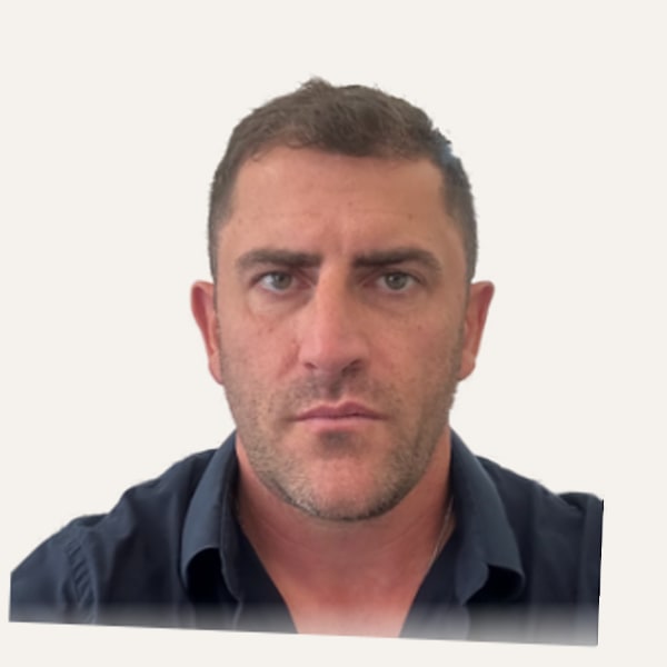 Dr. Nicolas Lari — Chirurgo di lifting viso (deep plane)