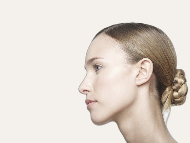 Dr. Sebastien Garson, deep plane facelift surgeon in Paris, France